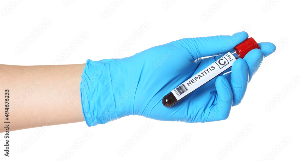 Obraz premium Scientist holding tube with blood sample and label Hepatitis C on white background, closeup
