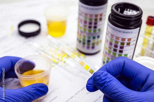 urine test, made with a vial of Urinalysis Reagent Strip used for ketosis control, laboratory examination. photo