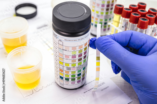 Vászonkép urine test, made with a vial of Urinalysis Reagent Strip used for ketosis control, laboratory examination