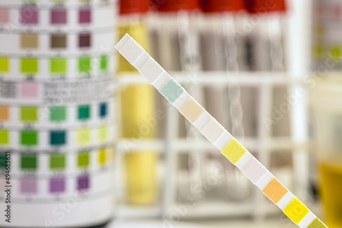 reagent strips used in urinalysis to analyze Leukocytes, Urobilinogen, Bilirubin, Blood, Nitrite, pH, Density, Protein, Glucose and Ketosis bodies. photo