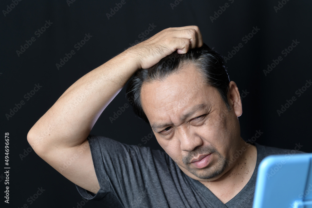A middle-aged man shines in the mirror and worry about hair loss or hair gray A middle-aged man shines in the mirror and worry about hair loss or hair gray
