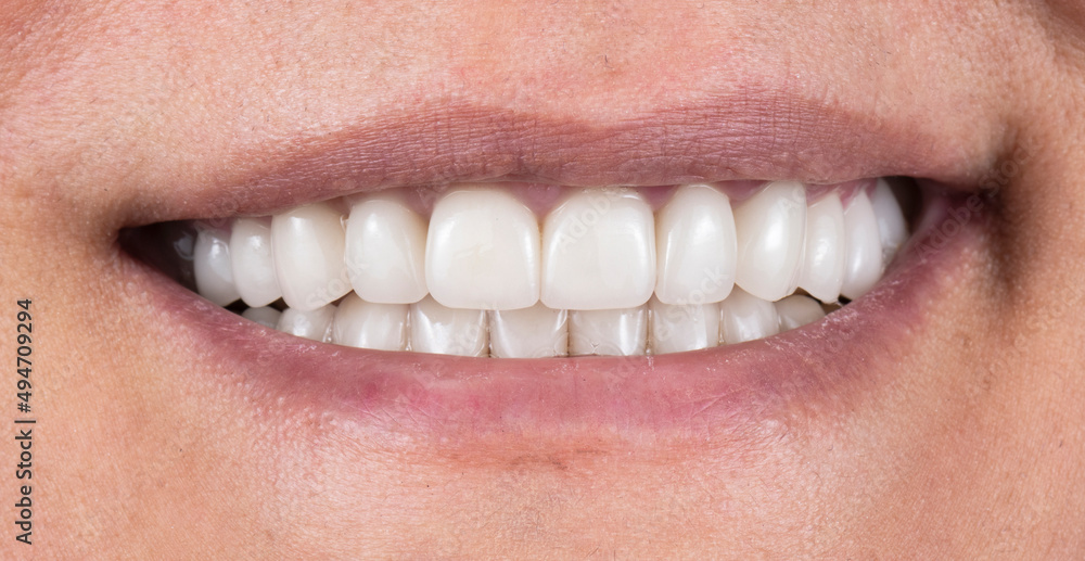 Obraz premium crowns and venners b1 color