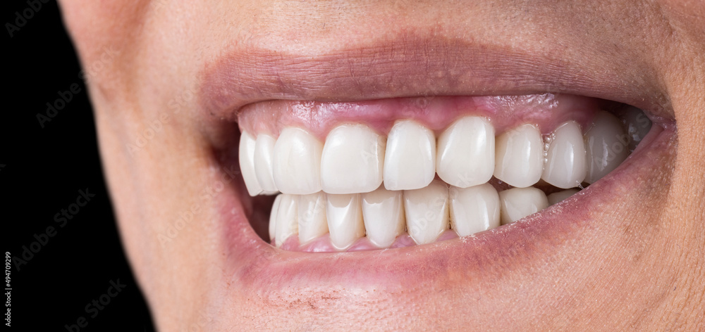 Fototapeta premium crowns and venners b1 color