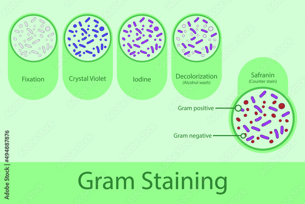 Diagram showing gram staining technique steps microbiology laboratory