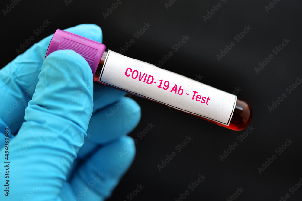 Obraz premium COVID-19 antibody test, blood sample tube for COVID-19 IgG antibody level test, after vaccination