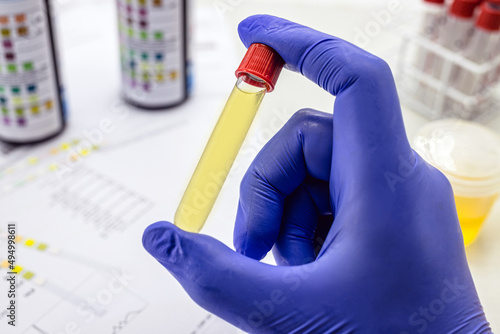 urine bottle held by healthcare professionals with latex glove, toxicology test photo