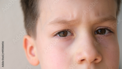 close-up of part of the child's face, boy 8-10 years old, sad, anxious face of teenager, difficult childhood, victim of domestic violence, psychological difficulties of loneliness, outsider photo