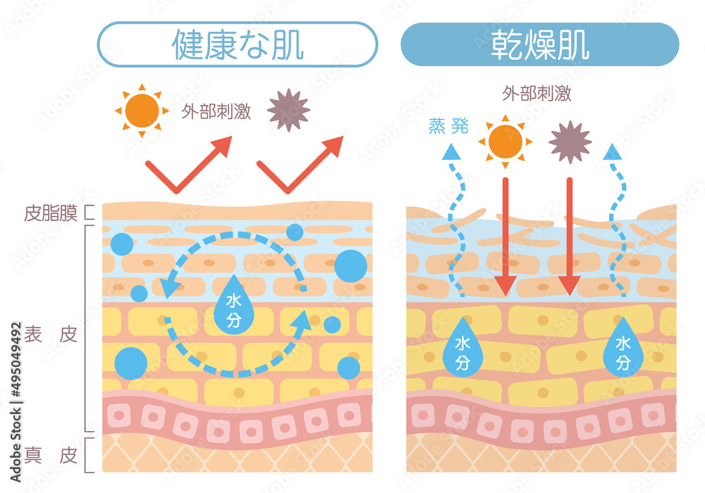 Φωτογραφία 皮膚の構造と肌タイプ比較イラスト｜乾燥肌