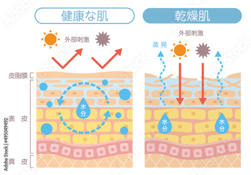肌の構造_乾燥肌