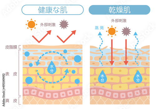 肌の構造_乾燥肌 photo