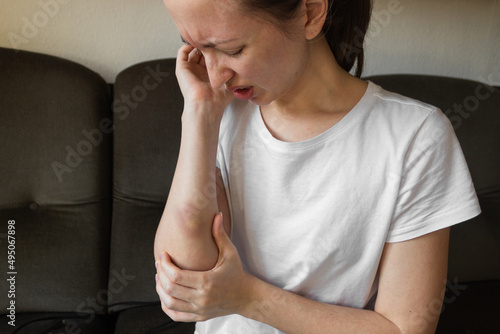 Suffering young woman in white t-shirt with large bruise on arm. Victim of domestic violence.