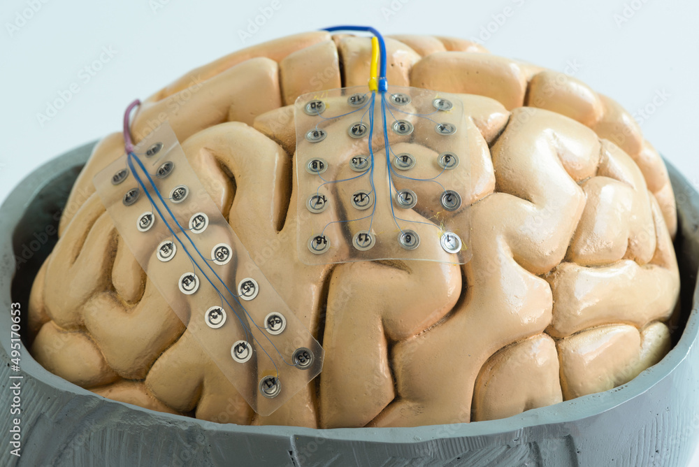 Subdural grid electrode for brain waves recording on the brain model