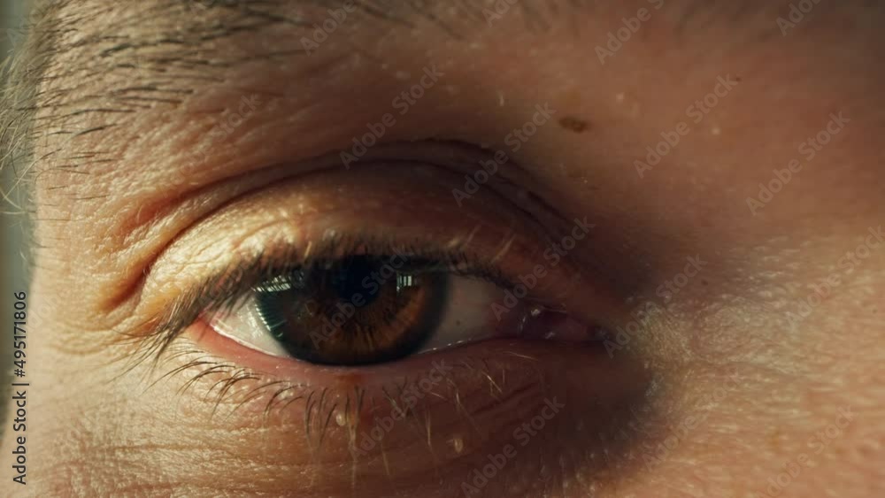 Macro shot of man's eye with fibroma. Fibroma on men skin. Skin care fibroma. Macro shot of man's eye with fibroma. Fibroma on men skin. Skin care fibroma.