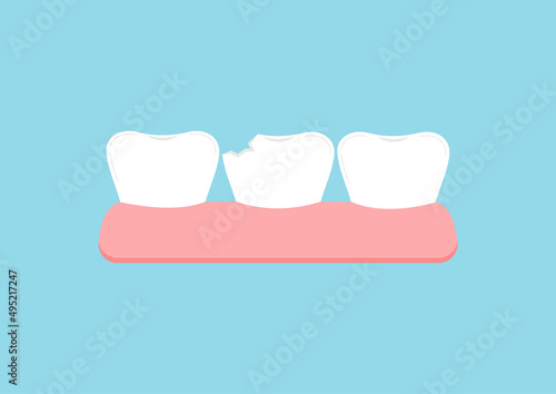 Chipped tooth in gum icon isolated on blue background. Broken teeth with problem treatment concept. Flat cartoon dentistry vector illustration. Dental health care design element.