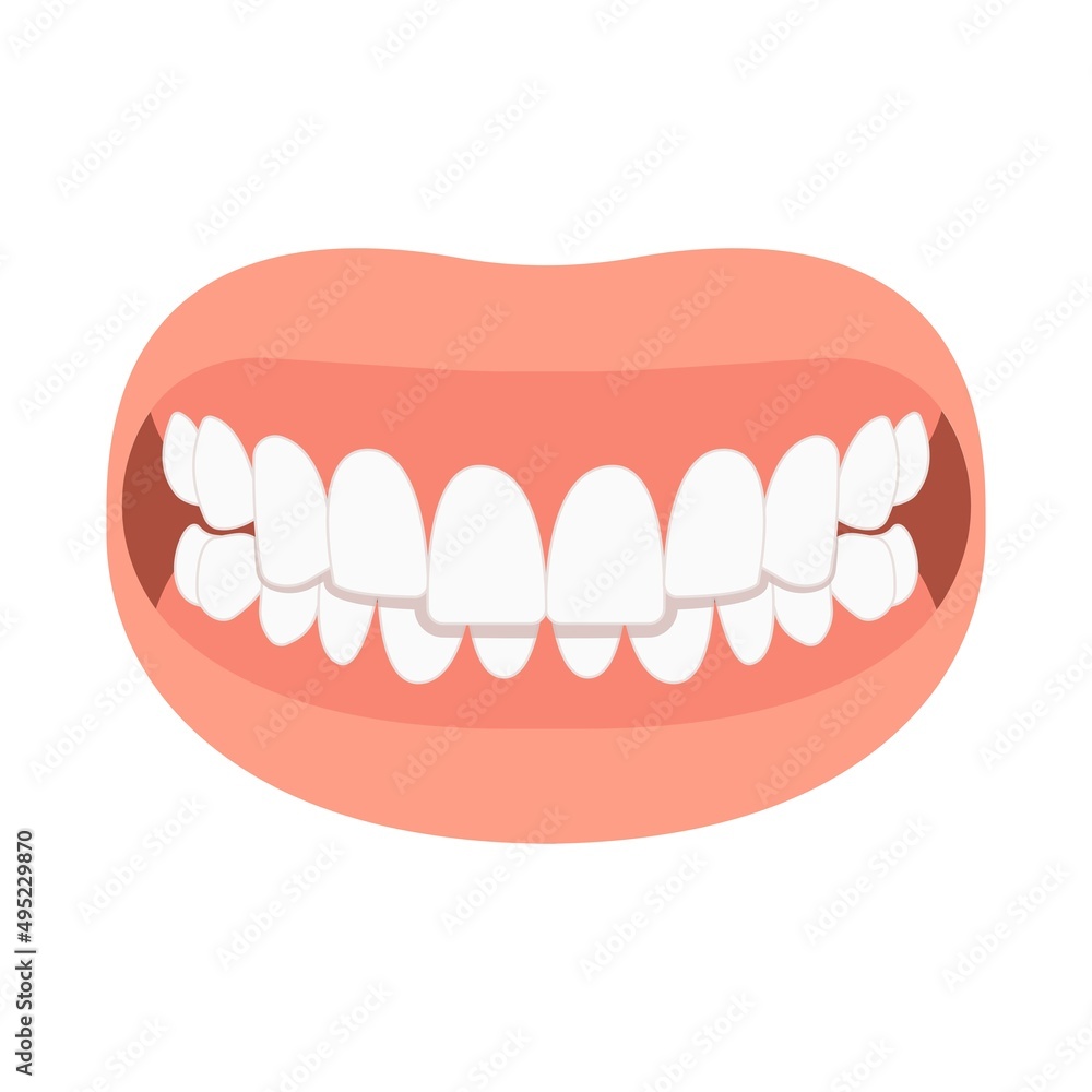 bad bite teeth mouth open deep gum Joint pain jaw surgery corrective bone oral smile Lower Weak Chin health extra Spacing Anterior fixed bad bite teeth mouth open deep gum Joint pain jaw surgery corrective bone oral smile Lower Weak Chin health extra Spacing Anterior fixed