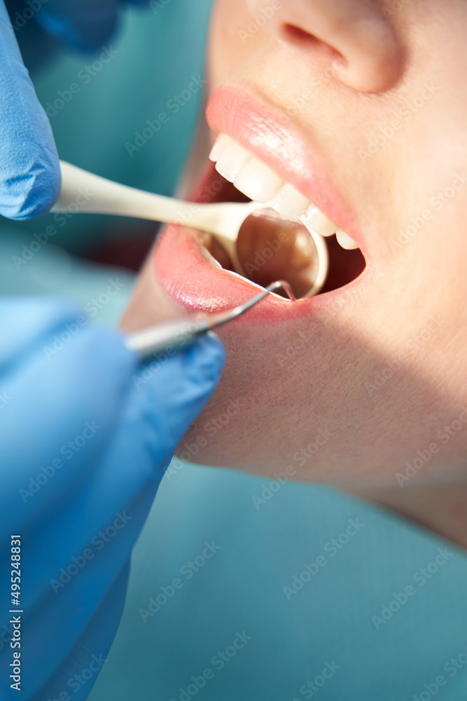 Dentist examining woman teeth in dental clinic