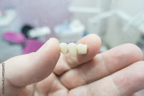 dental ceramic metal bridges in the hands