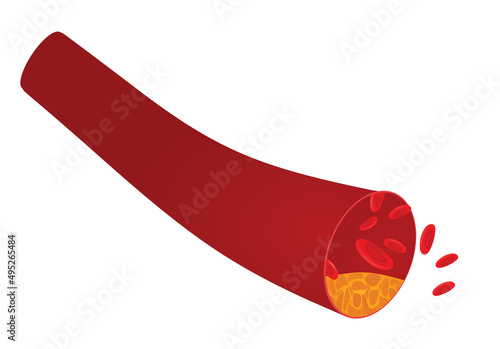 Vascular blood artery. vector illustration