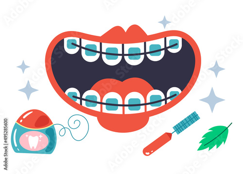 Cleaning brackets system tools. Vector flat graphic design cartoon illustration set