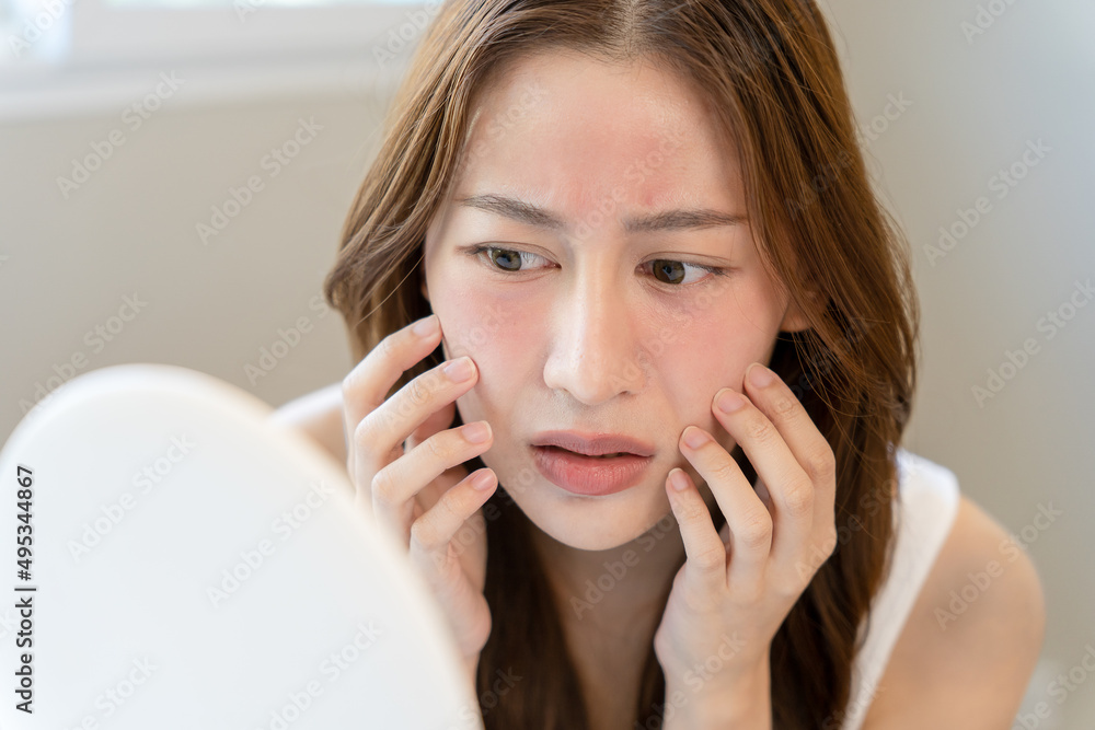 Young woman asian are worried about faces Dermatology and allergic to