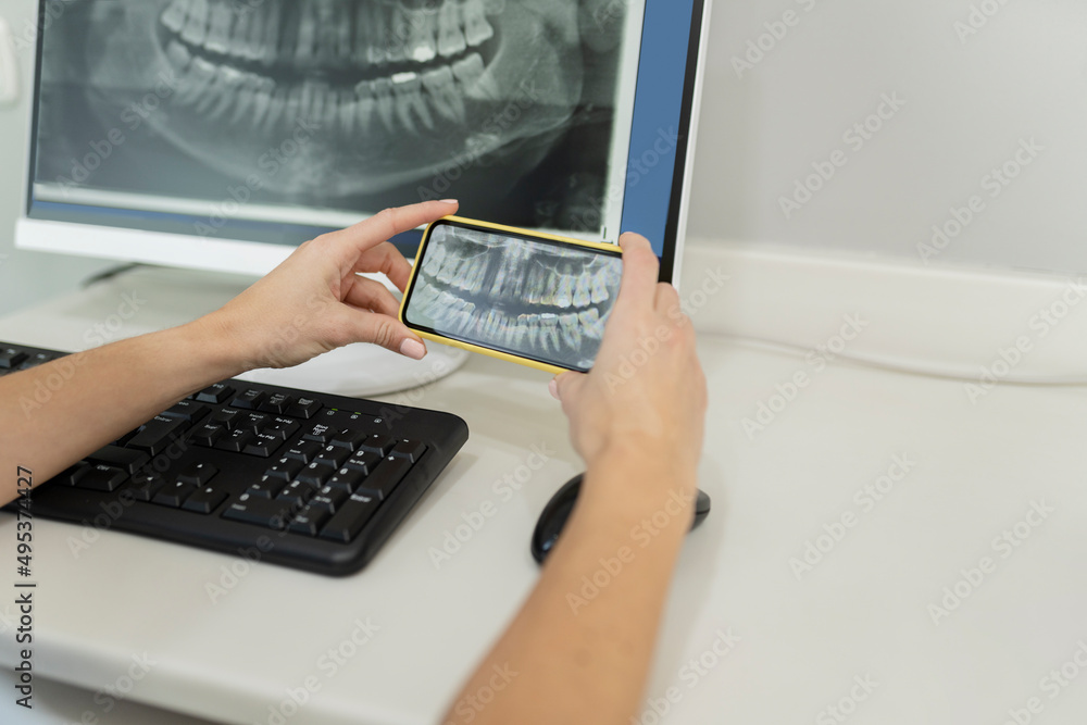 Dentist examining x-ray image through smart phone at dental clinic Dentist examining x-ray image through smart phone at dental clinic