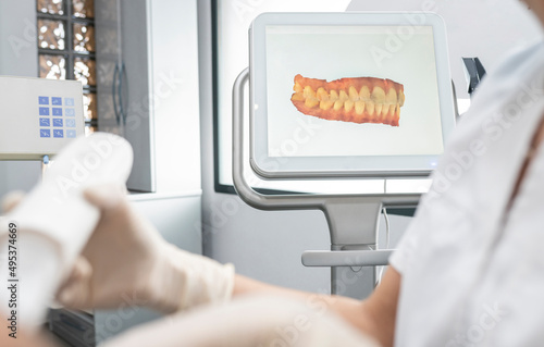 Dentist working by scanned image of teeth on monitor screen at dental clinic