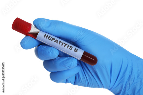Scientist holding tube with blood sample and label Hepatitis B on white background, closeup