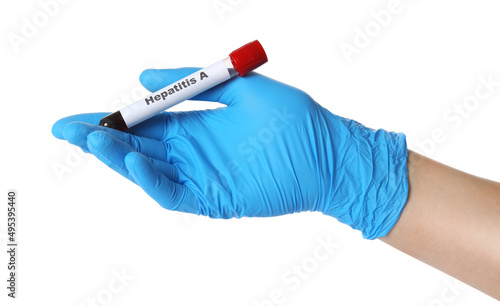 Scientist holding tube with blood sample and label Hepatitis A on white background, closeup