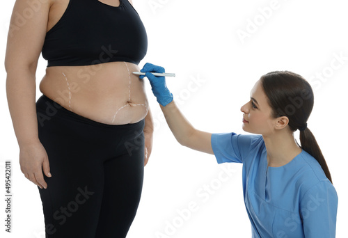 Doctor drawing marks on obese woman's body against white background. Weight loss surgery photo