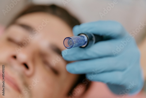 Microneedles for collagen induction therapy. a device with needles in close-up on a blurry background of a European man's face photo