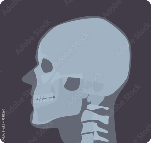Head X-ray Illustration