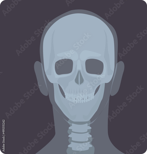 Head X-ray Illustration