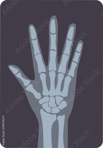 Hand X-ray Illustration