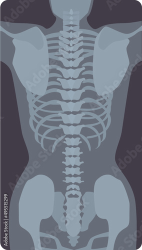 Back X-ray Illustration
