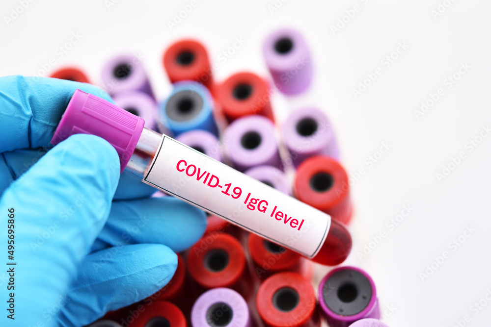 Fototapeta premium COVID-19 IgG level test, blood sample tube for COVID-19 antibody level test, after vaccination