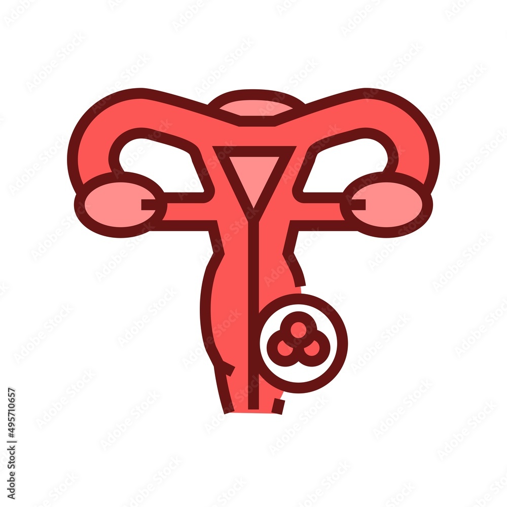 Cervical cancer icon. Female reproductive system disease illustration. Cervical cancer icon. Female reproductive system disease illustration.