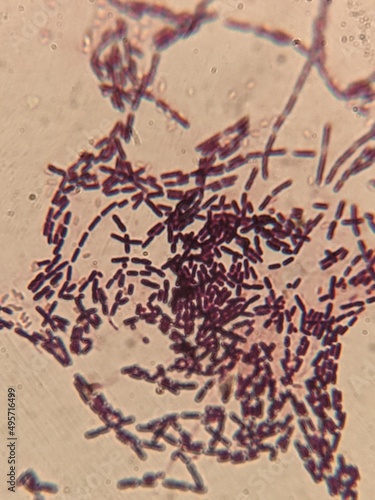 Photography photo of bacterial cells under the microscope