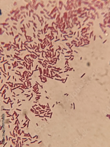 photo of bacterial cells under the microscope photo