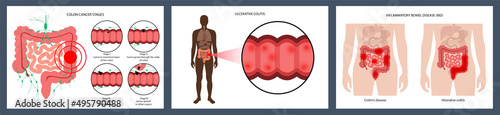 Intestines diseases concept