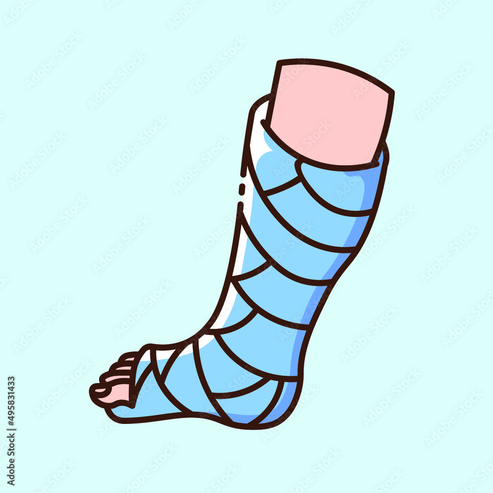Foot Cast Clipart