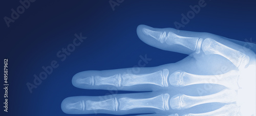 half hand blue xray image illustration