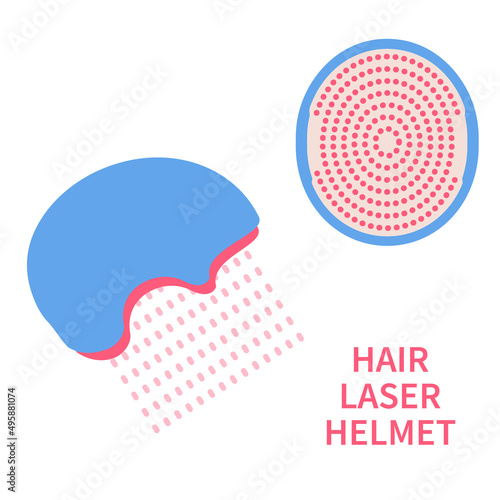 Laser hair growth helmet device. Red light therapy cap for hair restoration in androgenetic alopecia. Medical concept. Vector illustration.