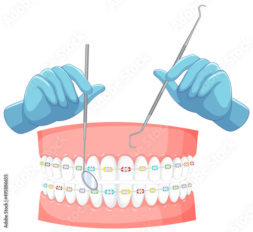 Dentist hand with human teeth braces model