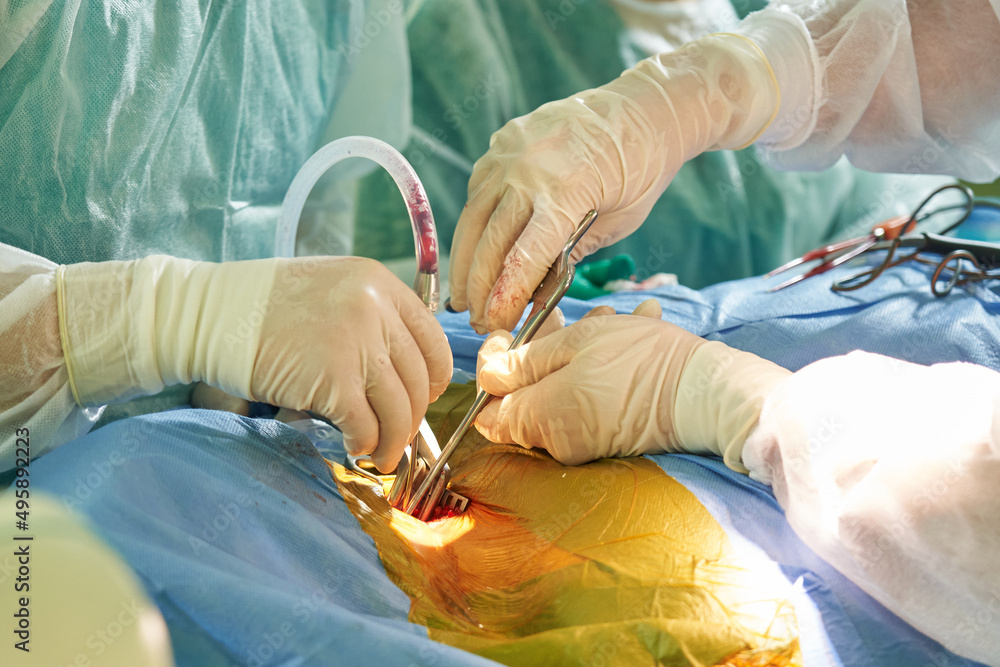 performing a medical operation in the operating room. hands of a surgeon in gloves close-up that hold the instrument, the hands of an assistant and a nurse performing a medical operation in the operating room. hands of a surgeon in gloves close-up that hold the instrument, the hands of an assistant and a nurse