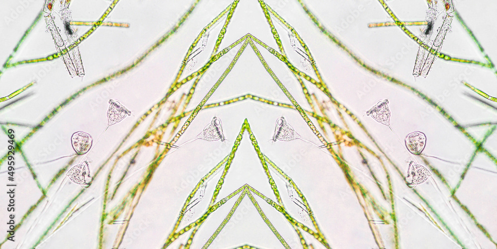 Vorticella microstoma with green algae under microscopic view