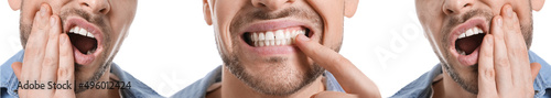 Set of man suffering from toothache on white background  closeup