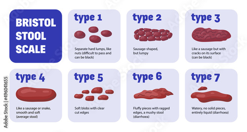 Bristol Stool Scale Composition