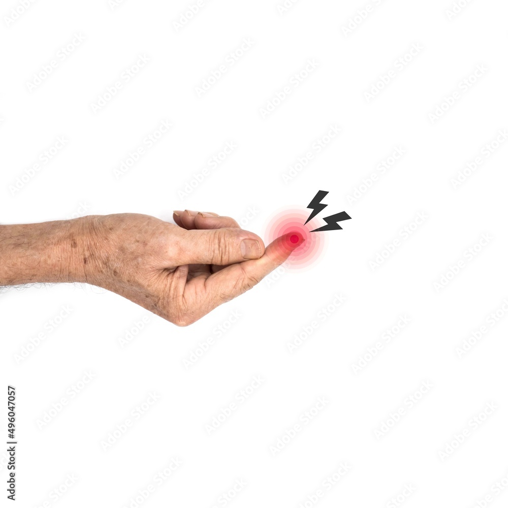Inflammation in fingertip of Asian man. Concept of cellulitis and finger problems Inflammation in fingertip of Asian man. Concept of cellulitis and finger problems