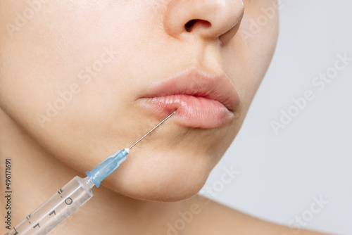 Cropped shot of young caucasian blonde woman's face with perfect lips with a syringe needle on lip. Injection of filler in lips. Lip augmentation, enhancement. Close up