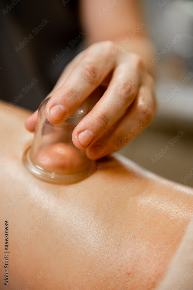 A woman's hand makes a vacuum massage with a medical jar on the leg  close-up. Vacuum massage jar. Stock Photo | Adobe Stock